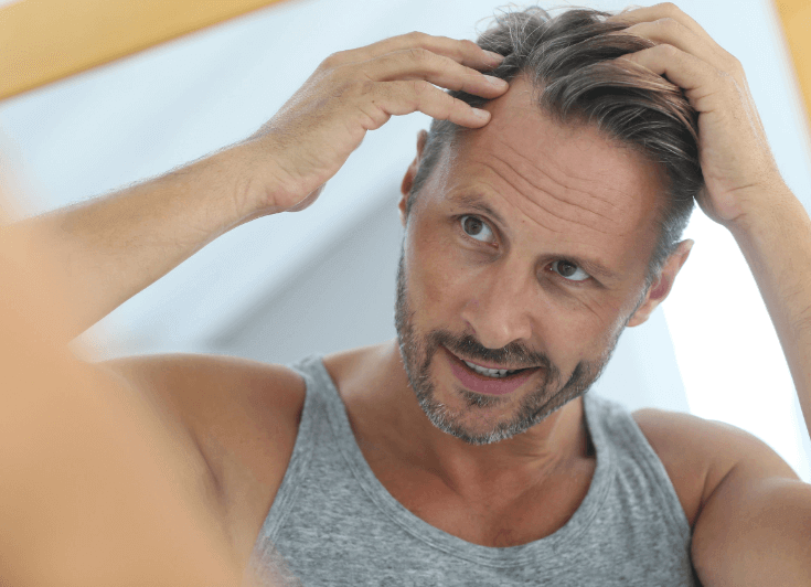 Hair Loss Concern in Mature Men